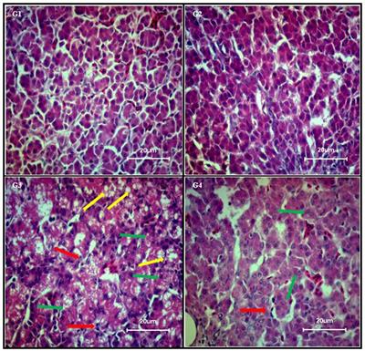 Dual Role of Dietary Curcumin Through Attenuating AFB1-Induced Oxidative Stress and Liver Injury via Modulating Liver Phase-I and Phase-II Enzymes Involved in AFB1 Bioactivation and Detoxification